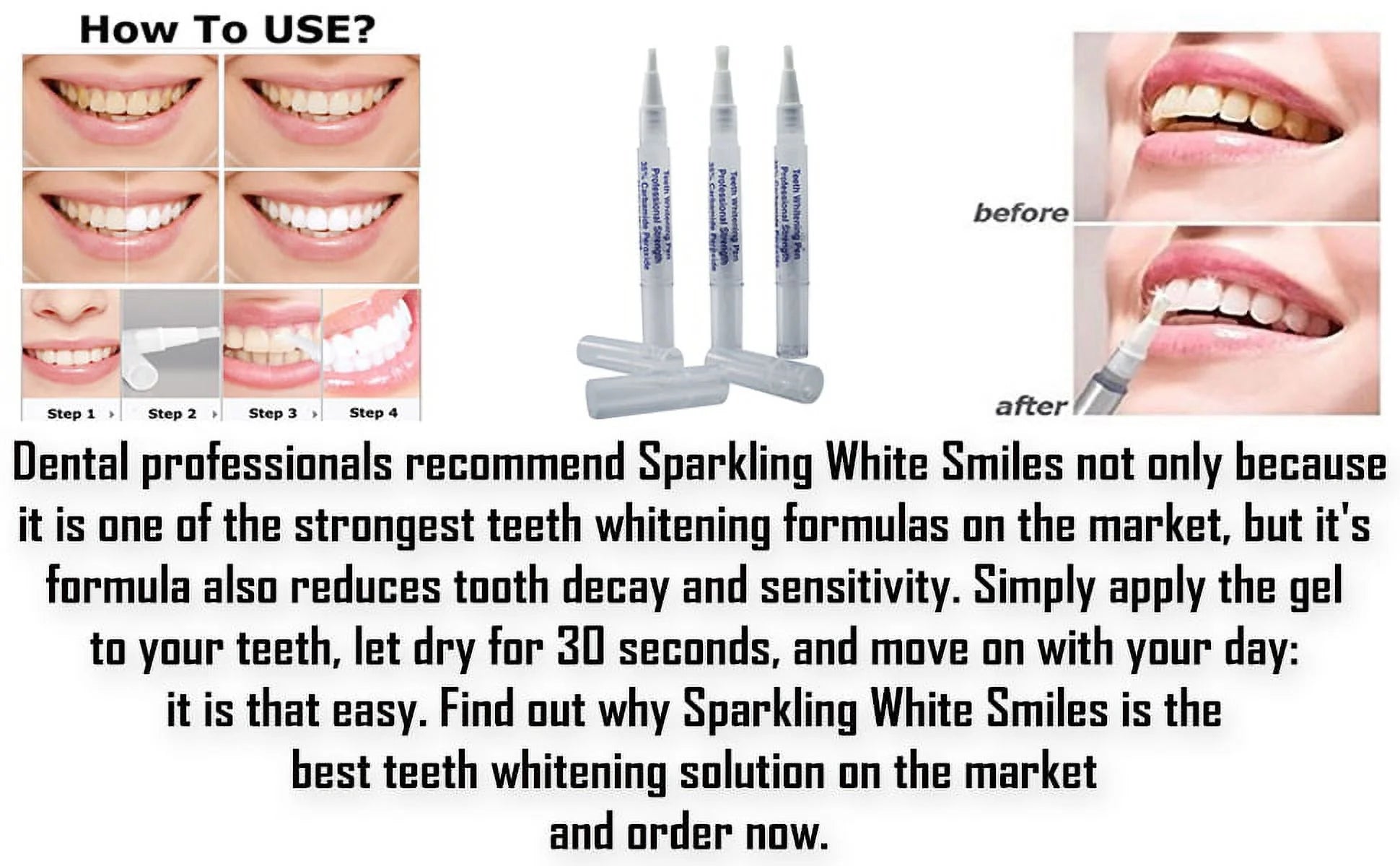 3-Pack Professional Teeth Whitening Pens - 35% Carbamide Peroxide - Fast Results for 80+ Treatments - Made in the USA